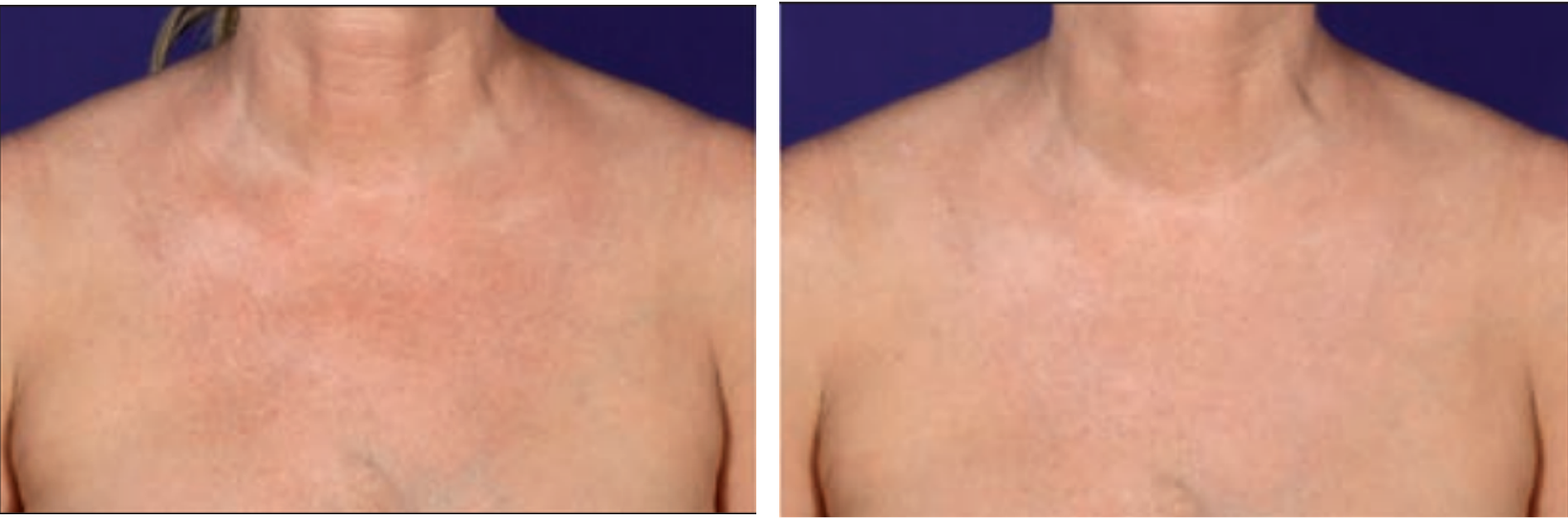 Adapted from fig 11 in ref 4